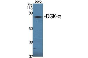 Western Blot (WB) analysis of specific cells using DGK-alpha Polyclonal Antibody.