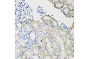 Immunohistochemistry of paraffin-embedded rat kidney using TGM5 antibody. (Transglutaminase 5 anticorps)