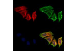 ABIN6265660 and ABIN6279885 staining Hela cells by IF/ICC.