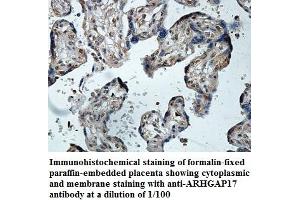 Image no. 1 for anti-rho GTPase Activating Protein 17 (ARHGAP17) antibody (ABIN1574792) (ARHGAP17 anticorps)