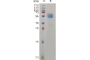 Human TM Protein, hFc Tag on SDS-PAGE under reducing condition.