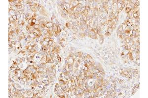 IHC-P Image Immunohistochemical analysis of paraffin-embedded H661 xenograft, using DOK1, antibody at 1:500 dilution.