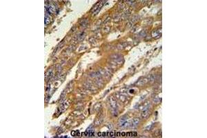 Immunohistochemistry (IHC) image for anti-PAN3 Poly(A) Specific Ribonuclease Subunit Homolog (PAN3) antibody (ABIN3002182) (PAN3 anticorps)