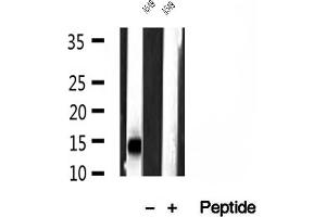 Western blot analysis of extracts of A549 cells, using SRX1 antibody.
