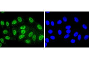 HepG2 cells were stained with SIRT1(T530) (6H5) Monoclonal Antibody  at [1:200] incubated overnight at 4C, followed by secondary antibody incubation, DAPI staining of the nuclei and detection. (SIRT1 anticorps  (pThr530))