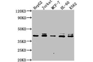 Western Blot Positive WB detected in: HepG2 whole cell lysate, Jurkat whole cell lysate, MCF-7 whole cell lysate, HL-60 whole cell lysate, K562 whole cell lysate All lanes: LSM11 antibody at 1:2000 Secondary Goat polyclonal to rabbit IgG at 1/50000 dilution Predicted band size: 40 kDa Observed band size: 40 kDa (LSM11 anticorps  (AA 1-141))