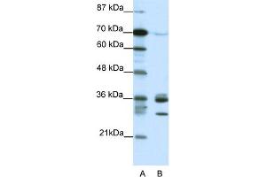 WB Suggested Anti-CDK5 Antibody Titration:  1.