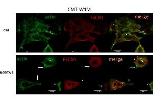 Representative confocal microscopy images of cytoskeletal protein F-actin and fascin 1 in CMT-W1M canine carcinoma cell line.
