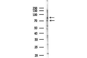 Western blot analysis of lysates from Rat brain, using NR1 Antibody at 1/1000 dilution.