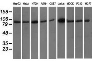 Western blot analysis of extracts (35 µg) from 9 different cell lines by using anti-PRKD2 monoclonal antibody. (PKD2 anticorps)