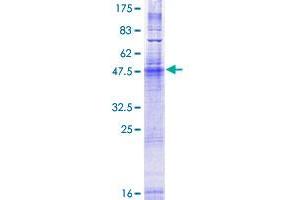 Image no. 1 for Surfeit 4 (SURF4) (AA 1-269) protein (GST tag) (ABIN7607768)