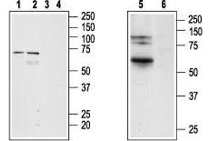 Western blot analysis of rat RBL basophilic leukemia (lanes 1 and 3), rat C6 brain glioma (lanes 2 and 4) and rat lung (lanes 5 and 6) lysates:1,2,5.