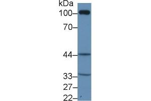 Detection of TP in Rat Kidney lysate using Polyclonal Antibody to Thromboxane Receptor (TP)