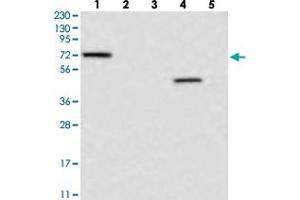Western blot analysis of Lane 1: RT-4, Lane 2: U-251 MG, Lane 3: Human Plasma, Lane 4: Liver, Lane 5: Tonsil with LRRC40 polyclonal antibody  at 1:250-1:500 dilution. (LRRC40 anticorps)