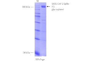 SDS-PAGE (SDS) image for SARS-CoV-2 Spike (P.1 - gamma) protein (rho-1D4 tag) (ABIN6964443)