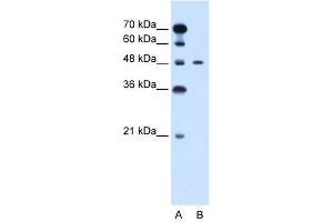 WB Suggested Anti-PBX1 Antibody Titration: 0. (PBX1 anticorps  (N-Term))