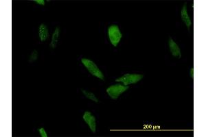 Immunofluorescence of monoclonal antibody to LRRFIP1 on HeLa cell. (LRRFIP1 anticorps  (AA 675-784))