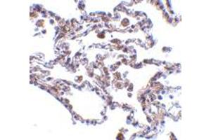 Immunohistochemistry of TRAF3IP2 in human lung tissue with TRAF3IP2 polyclonal antibody  at 5 ug/mL . (TRAF3IP2 anticorps  (AA 2-15))