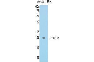Western blot analysis of the recombinant protein. (TNC anticorps  (AA 175-342))