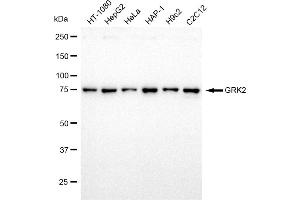 Western blotting analysis using GRK2 antibody (ABIN7797538).
