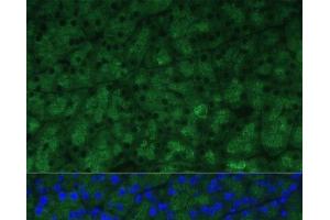 Immunofluorescence analysis of Mouse pancreas using CTRB1 Polyclonal Antibody at dilution of 1:100 (40x lens). (CTRB1 anticorps)