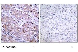 Image no. 1 for anti-Epidermal Growth Factor Receptor (EGFR) (pSer1070) antibody (ABIN196758) (EGFR anticorps  (pSer1070))