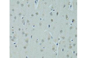 Immunohistochemistry of paraffin-embedded Rat brain using ZNF346 Polyclonal Antibody at dilution of 1:100 (40x lens). (ZNF346 anticorps)