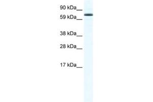 Western Blotting (WB) image for anti-Forkhead Box O6 (Foxo6) antibody (ABIN2461559) (Foxo6 anticorps)