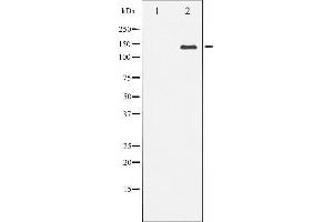 Western blot analysis of Bcr expression in HepG2 whole cell lysates,The lane on the left is treated with the antigen-specific peptide.