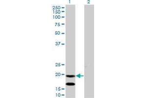 Western Blotting (WB) image for anti-Epithelial Membrane Protein 3 (EMP3) (AA 1-164) antibody (ABIN598660) (EMP3 anticorps  (AA 1-164))