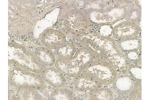 ABIN6256074 and ABIN6267116 at 1/100 staining human normal kidney tissue by IHC-P. (FLT3 anticorps  (pTyr969))