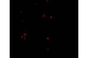 Immunofluorescence of MDA5 in Human Lymph Node cells with MDA5 Antibody  at 20 mg/ml (IFIH1 anticorps  (Center))