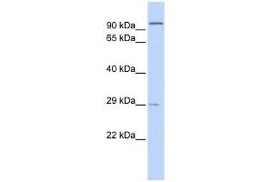 Sarcospan antibody used at 1 ug/ml to detect target protein. (SSPN anticorps)