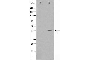 Western blot analysis on LOVO cell lysate using Synaptophysin Antibody,The lane on the left is treated with the antigen-specific peptide. (Synaptophysin anticorps  (Internal Region))