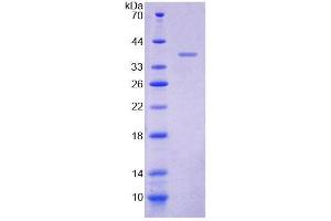 SDS-PAGE analysis of Human MYOM2 Protein. (MYOM2 Protéine)