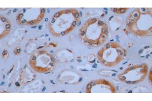 Detection of CD74 in Human Kidney Tissue using Polyclonal Antibody to Cluster Of Differentiation 74 (CD74)