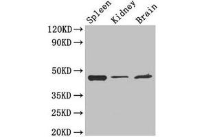 Western Blot Positive WB detected in: Mouse spleen tissue, Mouse kidney tissue, Mouse brain tissue All lanes: LAMP2 antibody at 4 μg/mL Secondary Goat polyclonal to rabbit IgG at 1/50000 dilution Predicted band size: 45, 46 kDa Observed band size: 45 kDa (LAMP2 anticorps  (AA 54-268))