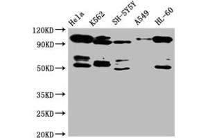 Western Blot Positive WB detected in: Hela whole cell lysate, SH-SY5Y whole cell lysate, K562 whole cell lysate All lanes: OFD1 antibody at 1:2000 Secondary Goat polyclonal to rabbit IgG at 1/50000 dilution Predicted band size: 117, 43, 112 kDa Observed band size: 117 kDa (OFD1 anticorps  (AA 598-771))
