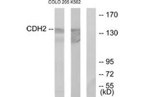 Western blot analysis of extracts from COLO205/K562 cells, using CDH2 Antibody. (N-Cadherin anticorps  (AA 721-770))