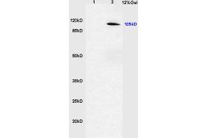 Lane 1: rat brain lysates Lane 2: human gastric carcinoma lysates probed with Anti phospho-CYLD(Ser418) Polyclonal Antibody, Unconjugated (ABIN683833) at 1:200 in 4 °C. (CYLD anticorps  (pSer418))