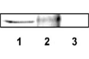 Western blot analysis of DLX4 using DLX4 polyclonal antibody . (DLX4 anticorps  (AA 1-60))