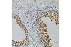 Immunohistochemistry of paraffin-embedded human prostate using TRPA1 antibody. (TRPA1 anticorps)