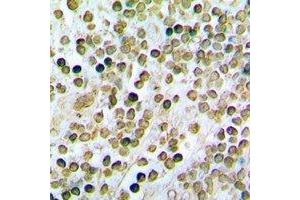 Immunohistochemical analysis of STAMBP staining in rat spleen formalin fixed paraffin embedded tissue section.