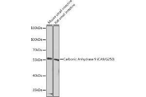 Western blot analysis of extracts of various cell lines, using Carbonic Anhydrase 9 (C/G250) Antibody (ABIN6131266, ABIN6137798, ABIN6137800 and ABIN6217767) at 1:1000 dilution. (CA9 anticorps  (AA 52-151))
