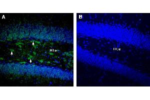 Expression of RGMA in mouse hippocampus:Immunohistochemical staining of perfusion-fixed frozen mouse brain sections with Anti-RGMA (extracellular) Antibody (ABIN7581951), (1:300), followed by goat anti-rabbit-AlexaFluor-488.