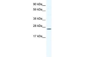 WB Suggested Anti-BRF1 Antibody Titration:  1.