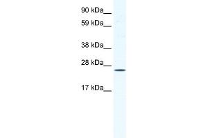 WB Suggested Anti-BRF1 Antibody Titration:  1. (BRF1 anticorps  (C-Term))