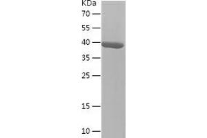 Western Blotting (WB) image for L-2-Hydroxyglutarate Dehydrogenase (L2HGDH) (AA 80-249) protein (His-IF2DI Tag) (ABIN7123702)