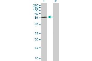 Western Blot analysis of CYP2R1 expression in transfected 293T cell line by CYP2R1 MaxPab polyclonal antibody. (CYP2R1 anticorps  (AA 1-501))