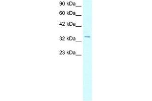 WB Suggested Anti-HOXD12 Antibody Titration:  5. (HOXD12 anticorps  (N-Term))